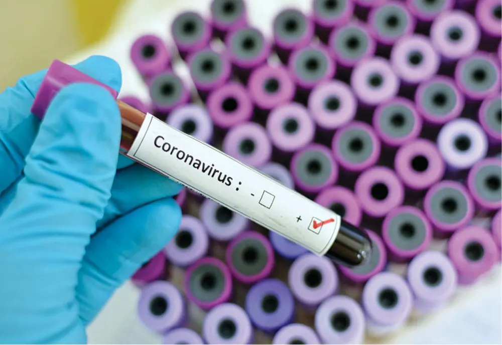 3.400 de cazuri noi de persoane infectate cu SARS – CoV - 2