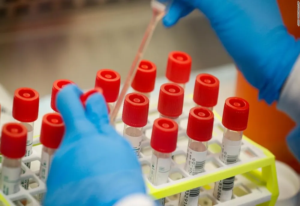 De o săptămână se pot face teste pentru depistarea SARS-COV-2 și la Spitalul de Psihiatrie și Neurologie din Brașov