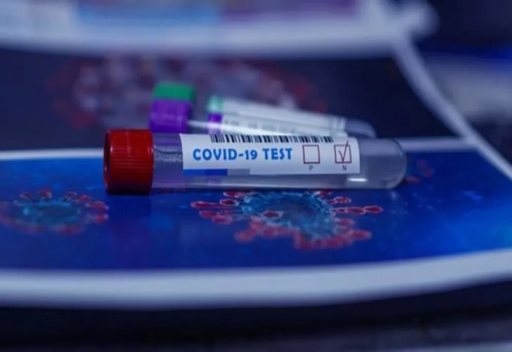 Bilanț coronavirus 29 ianuarie: 2.737 de cazuri noi, 91 de decese