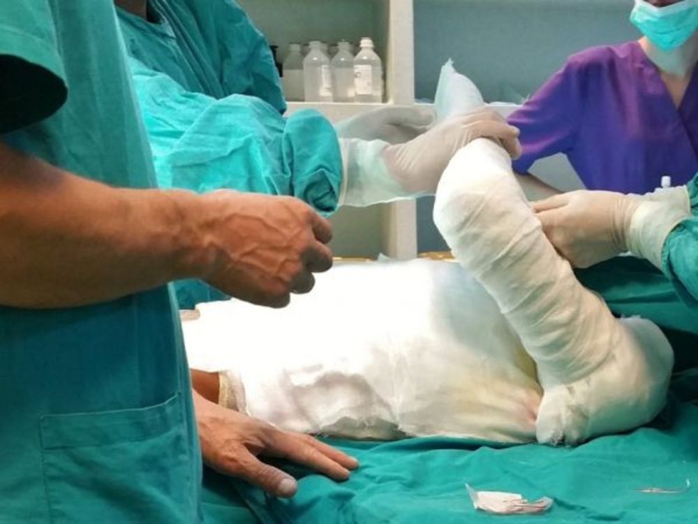 Femeie cu arsuri grave, internată la Brașov, dar operată la Iași, după două săptămâni! Ministrul Sănătății: "Medicii de la Brașov și-au făcut treaba"