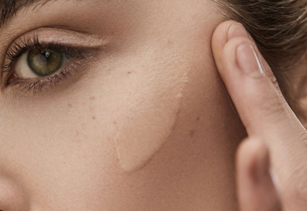 Pete pigmentare: ce sunt, din ce cauze apar și cum le reducem vara