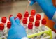 De o săptămână se pot face teste pentru depistarea SARS-COV-2 și la Spitalul de Psihiatrie și Neurologie din Brașov