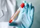 Brașovul, județul cu cele mai multe cazuri noi de infectare cu coronavirus din țară, în ultimele 24 de ore!